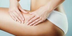 Cellulite sur les cuisses