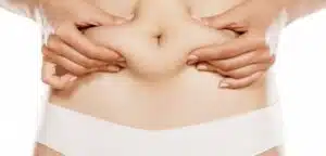 Cosmetic surgery on my stomach