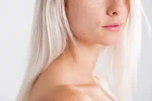 Photorajeunissement