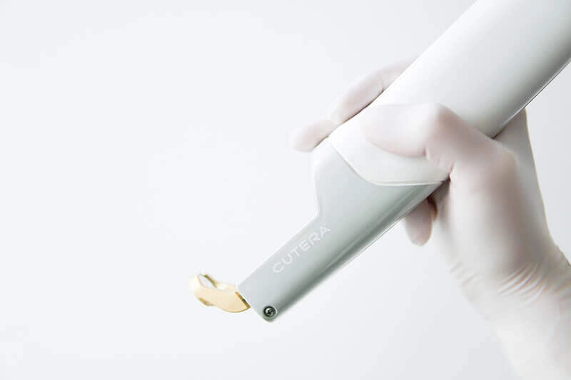 laser vasculaire tarif