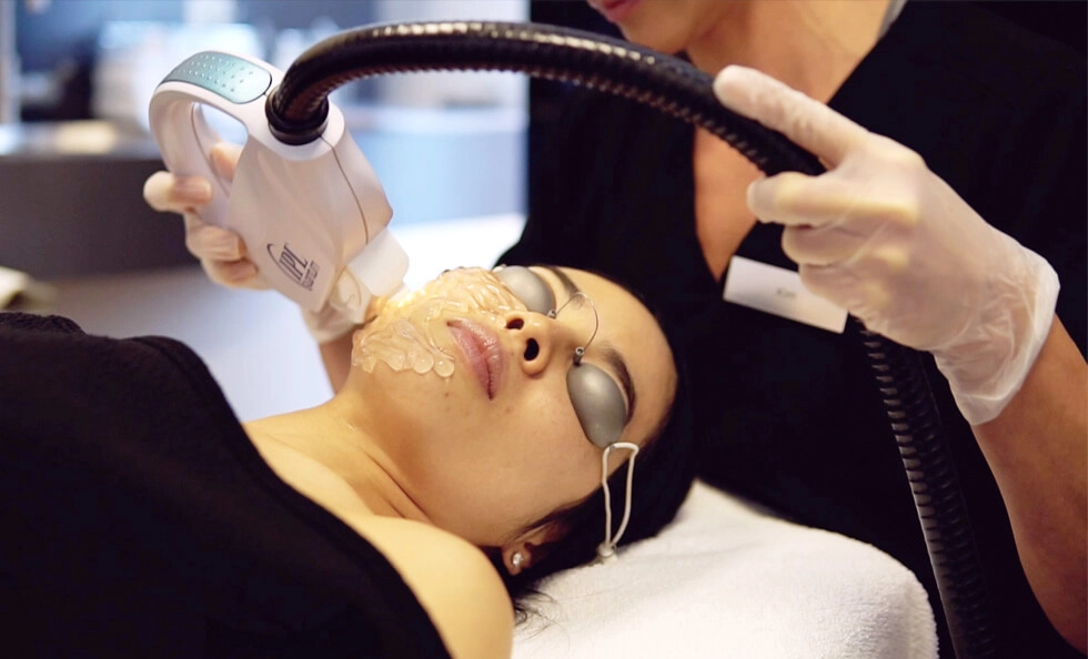 Photorejuvenate treatment