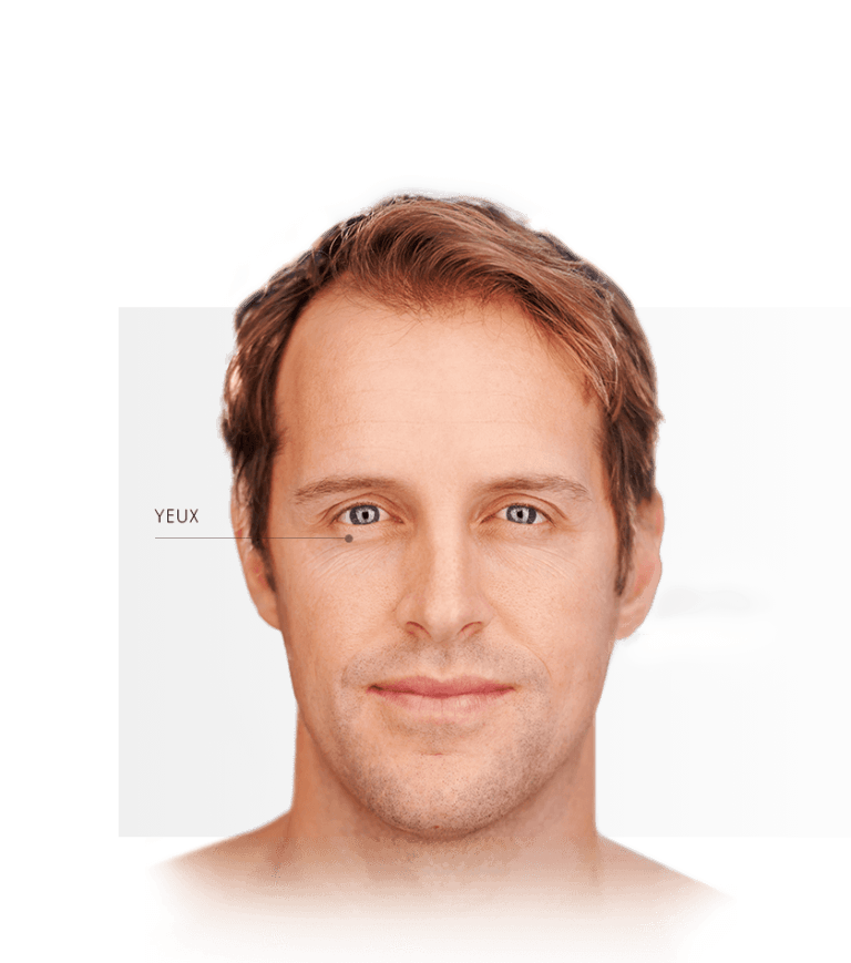 Zones traitables Fotona yeux homme
