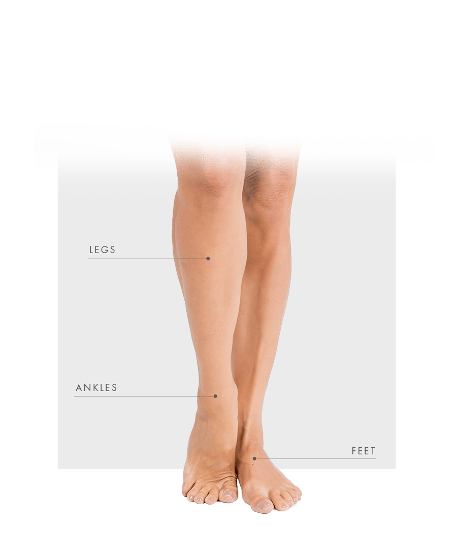 Sclerotherapy women