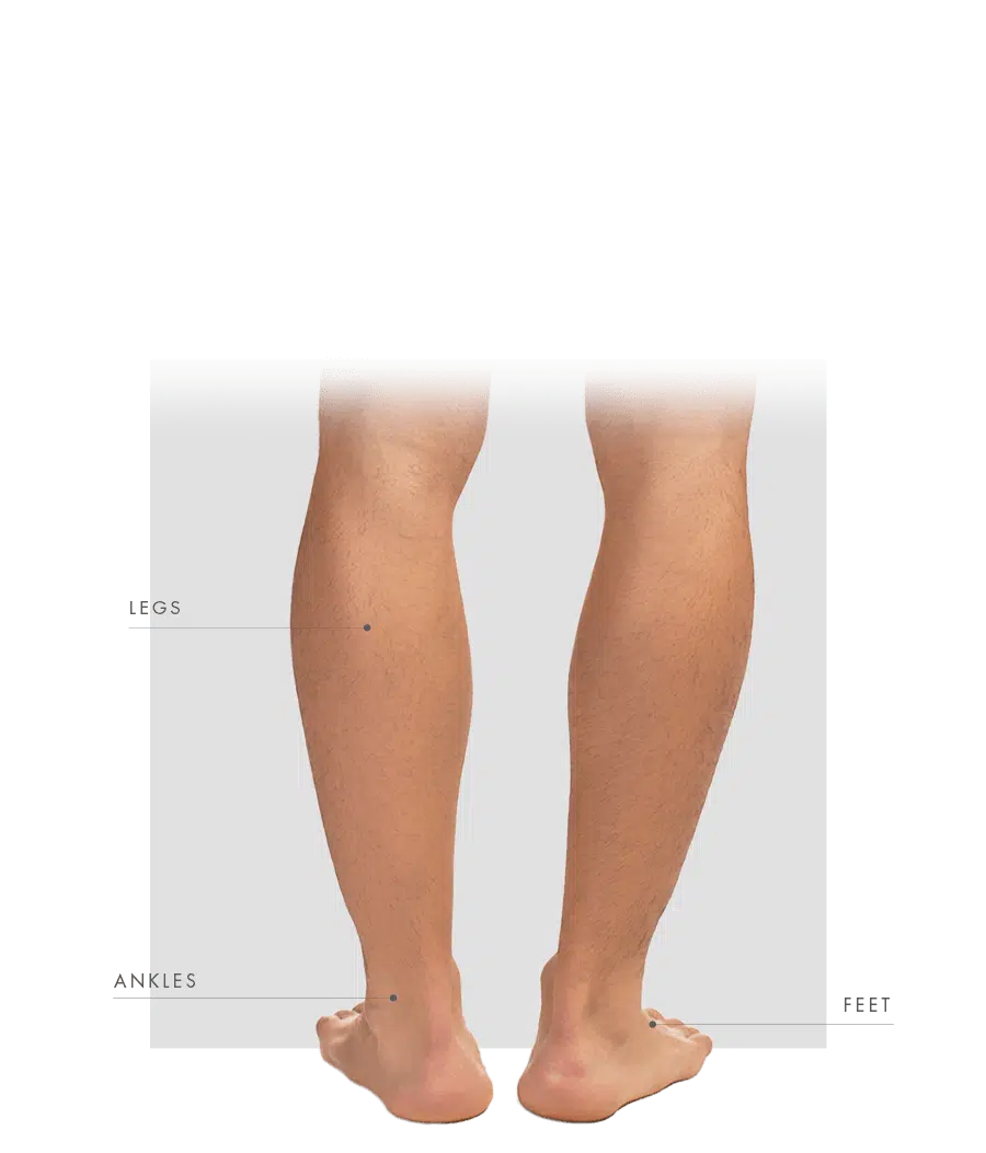 Endovenous Laser Treatable Areas men