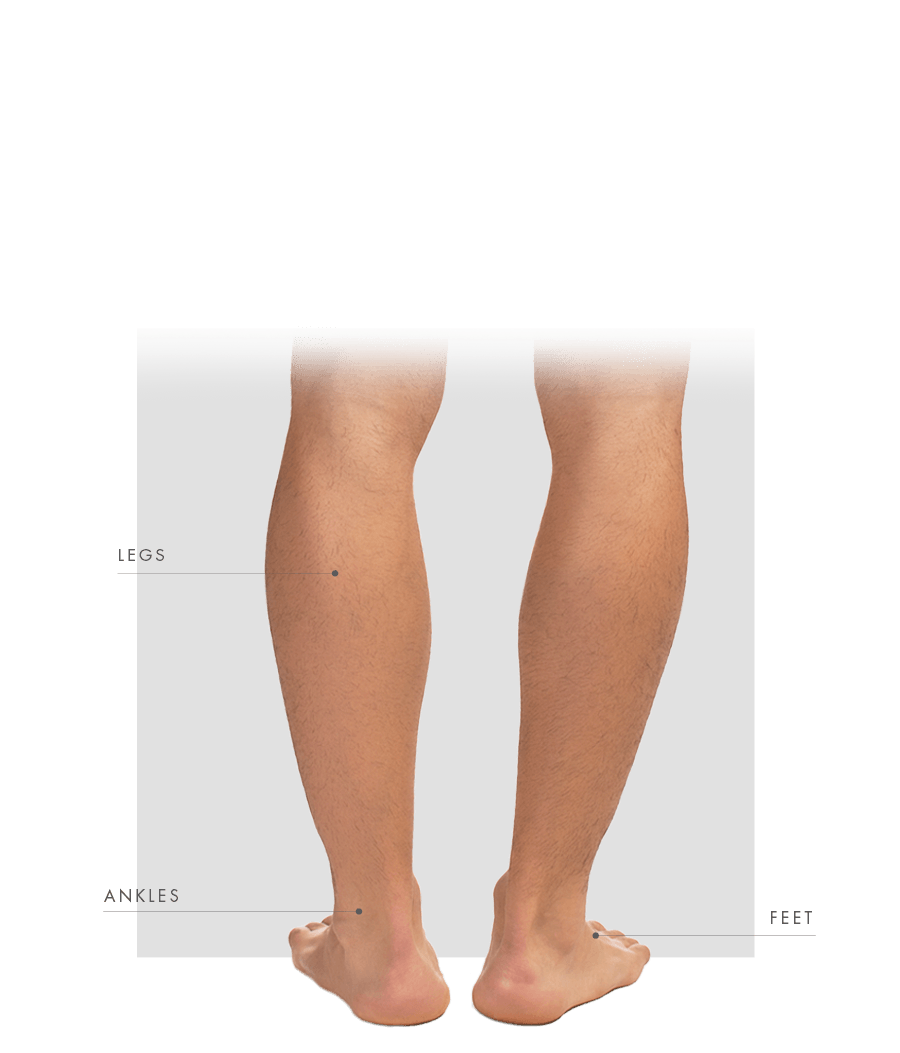 Sclerotherapy men