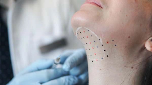 A dermapure physician treating a patient