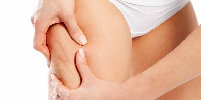 Lutter contre la cellulite