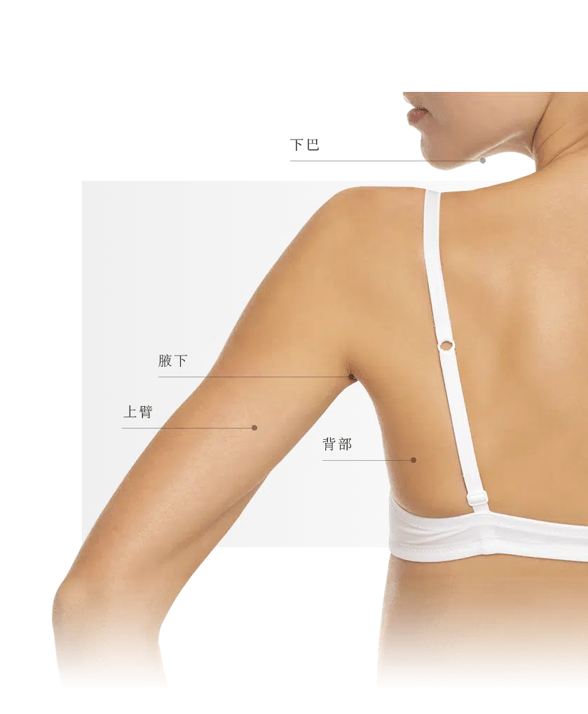 Coolsculpting zones dos femme