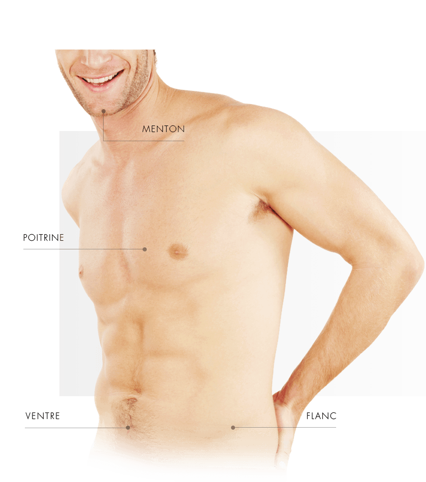 coolsulpting homme torse