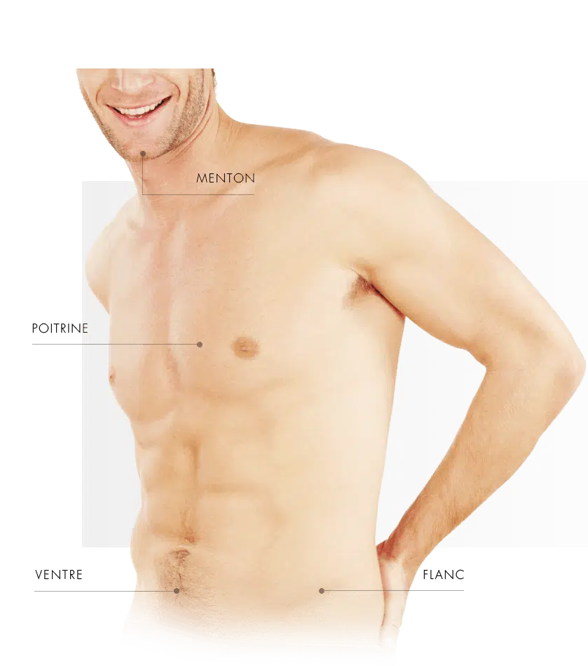 coolsulpting homme torse
