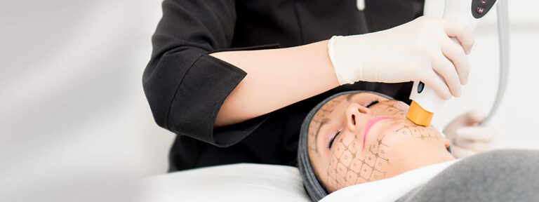 Traitement de thermage chez Dermapure