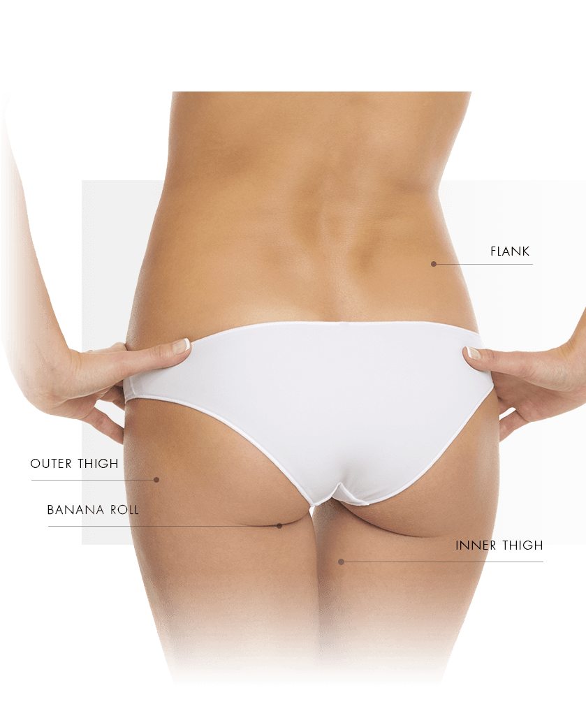 coolsculpting treatment zone women