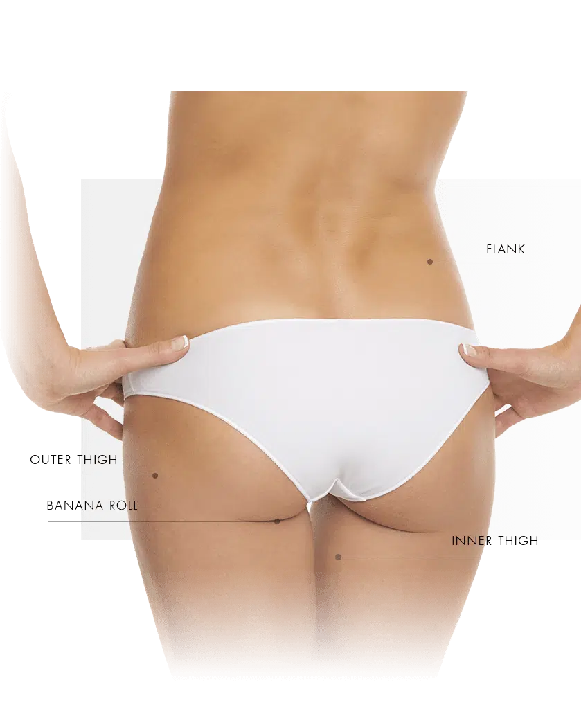 coolsculpting treatment zone women