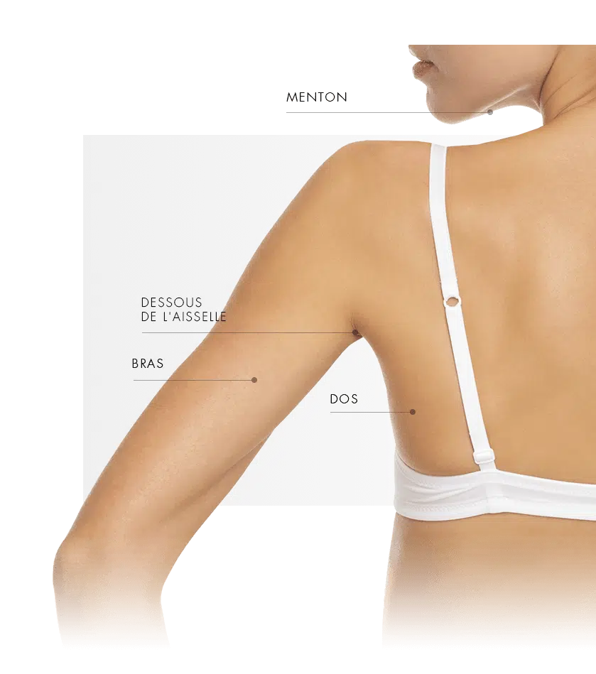 dermapure coolsculpting femme dos