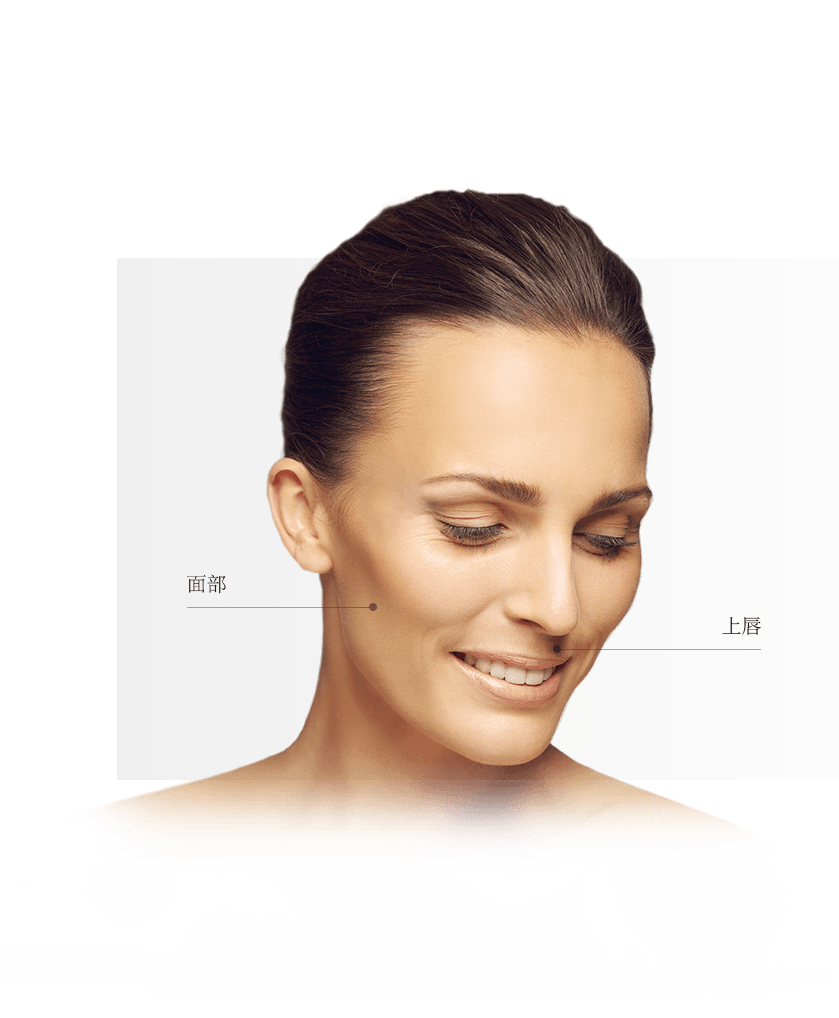 Epilation zones visage femme