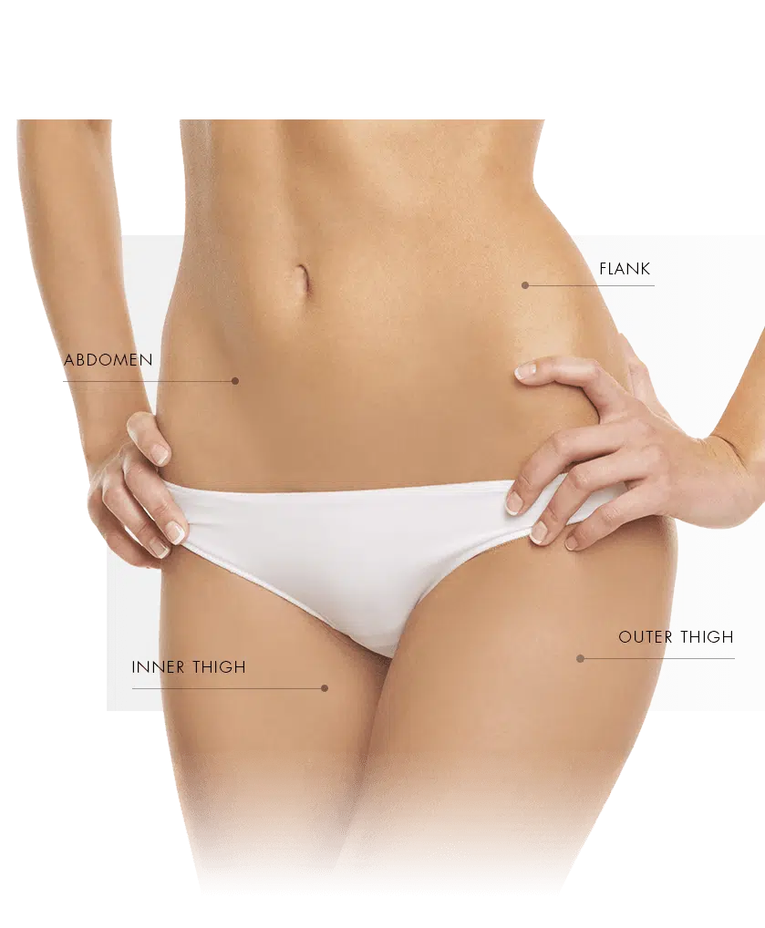 coolsculpting treatment zone women