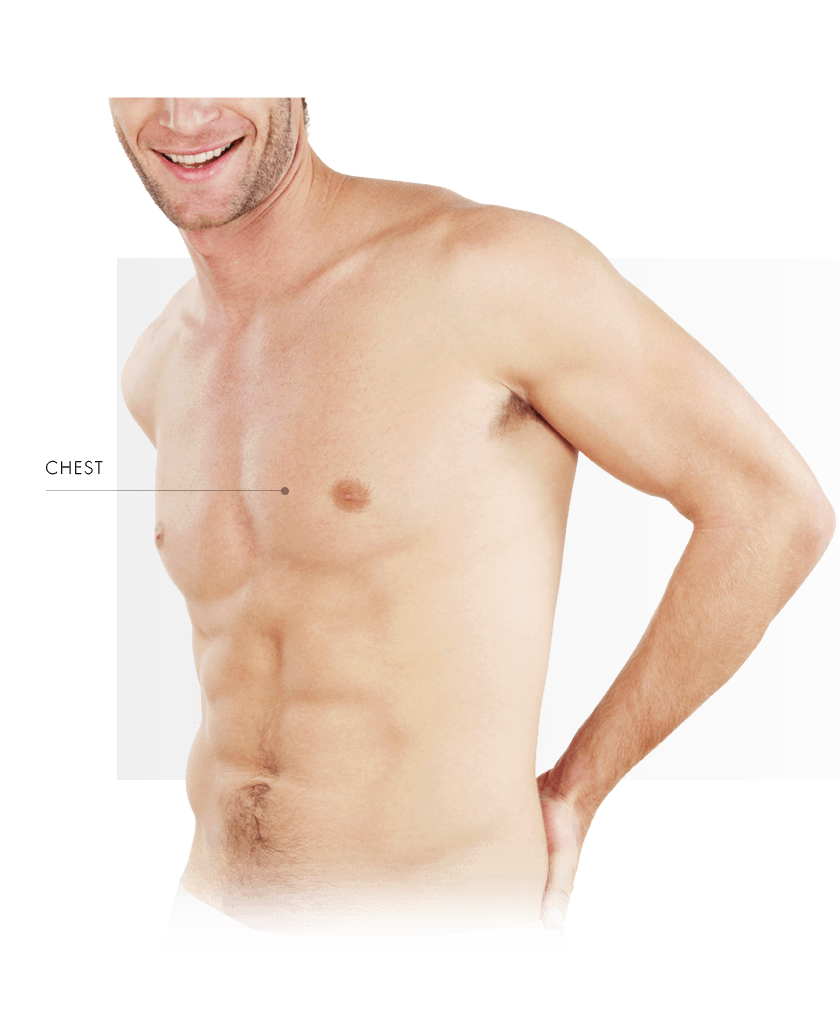Treatment Areas Vascular Lasers men chest