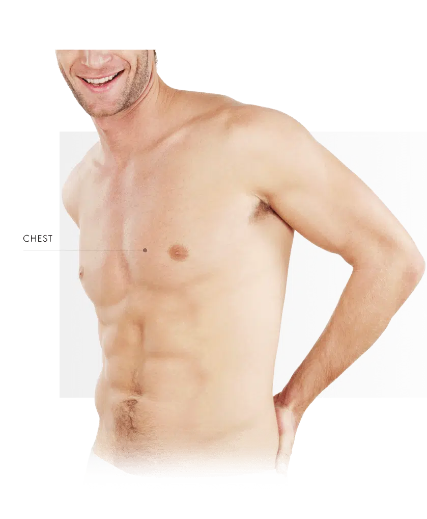 Treatment Areas Vascular Lasers men chest