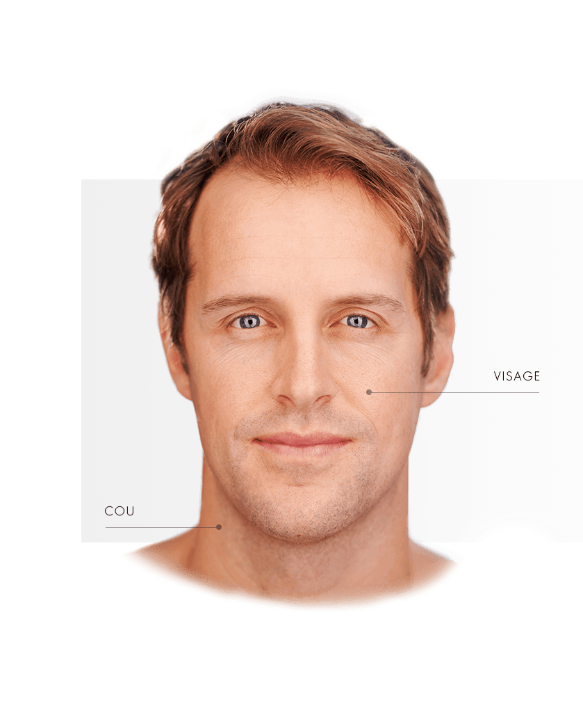 laser medicaux homme
