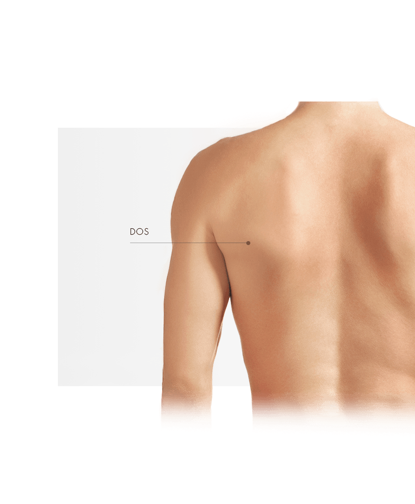 laser medicaux homme dos