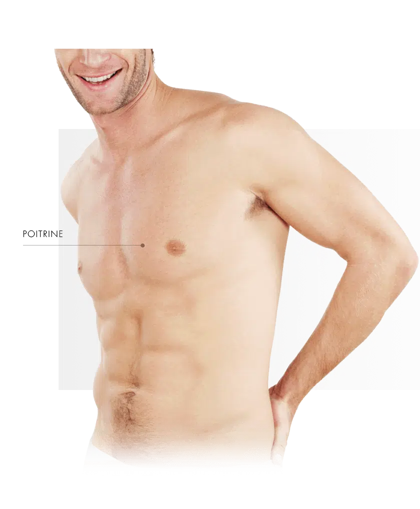 laser medicaux homme torse