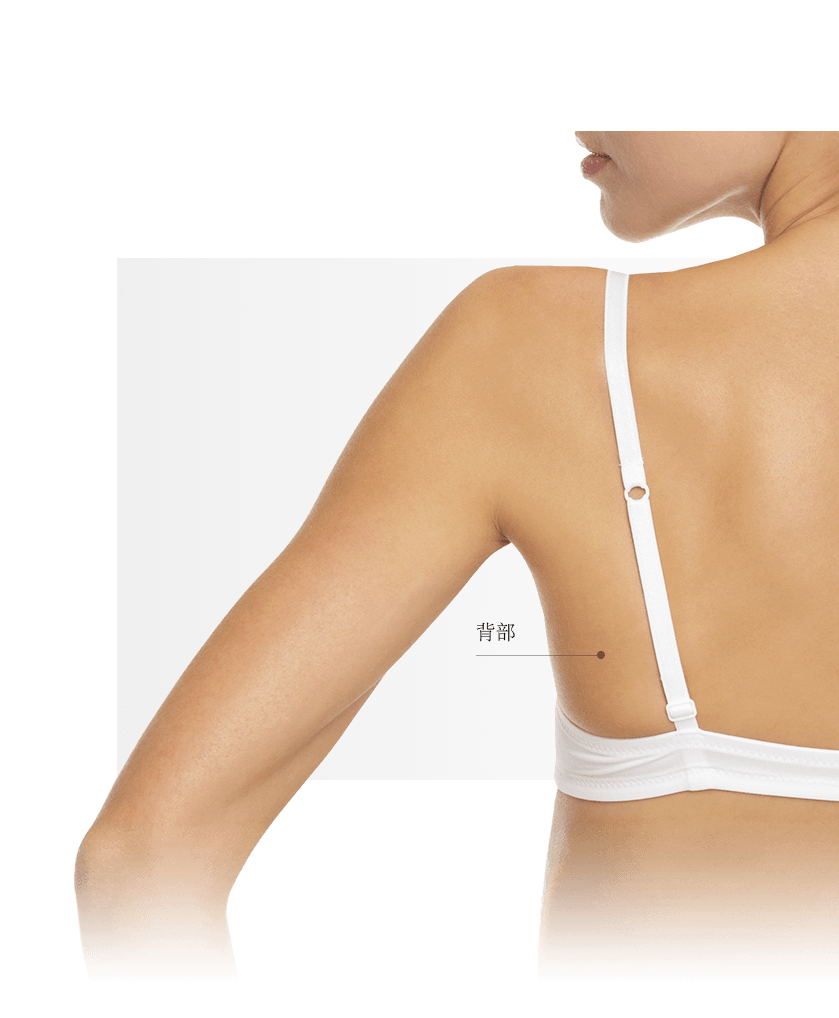 Lasers vasculaires zones dos femme