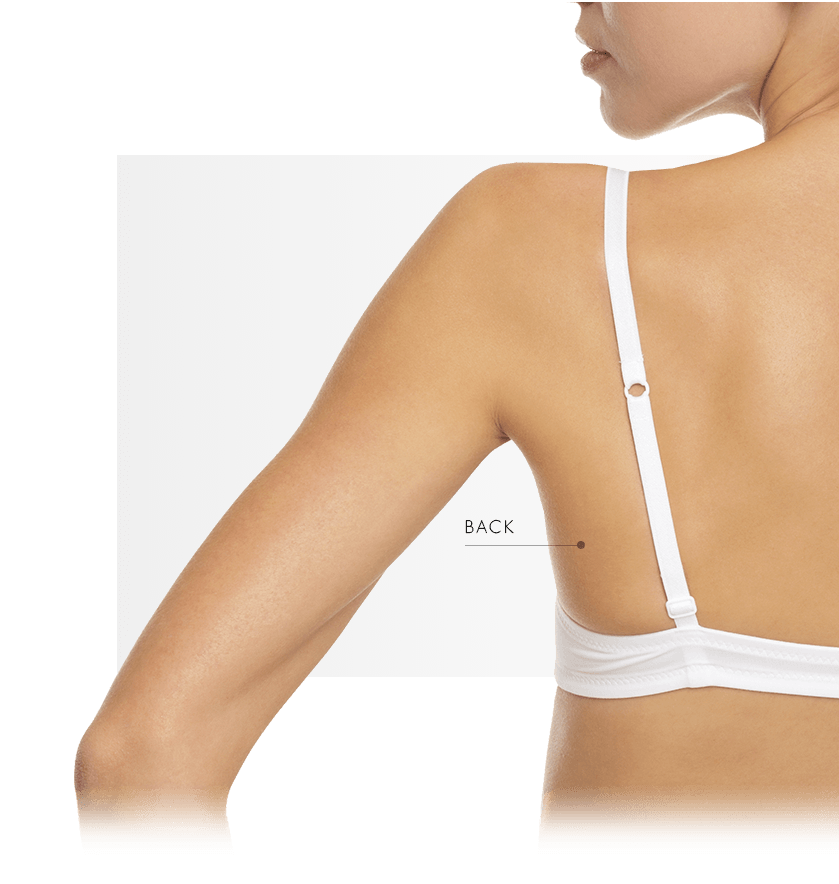 microdermabrasion women back