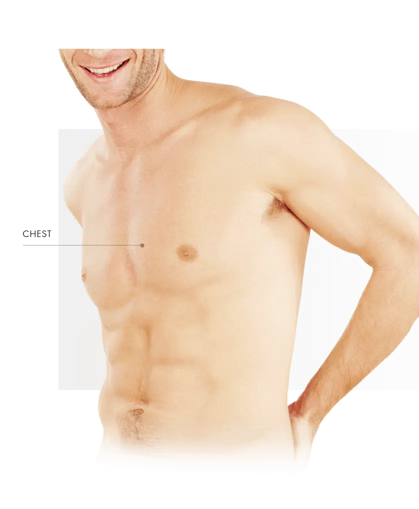 Photorejuvenation men chest