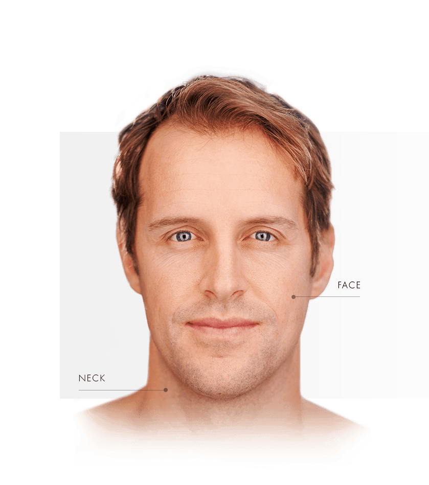 Photorejuvenation men face