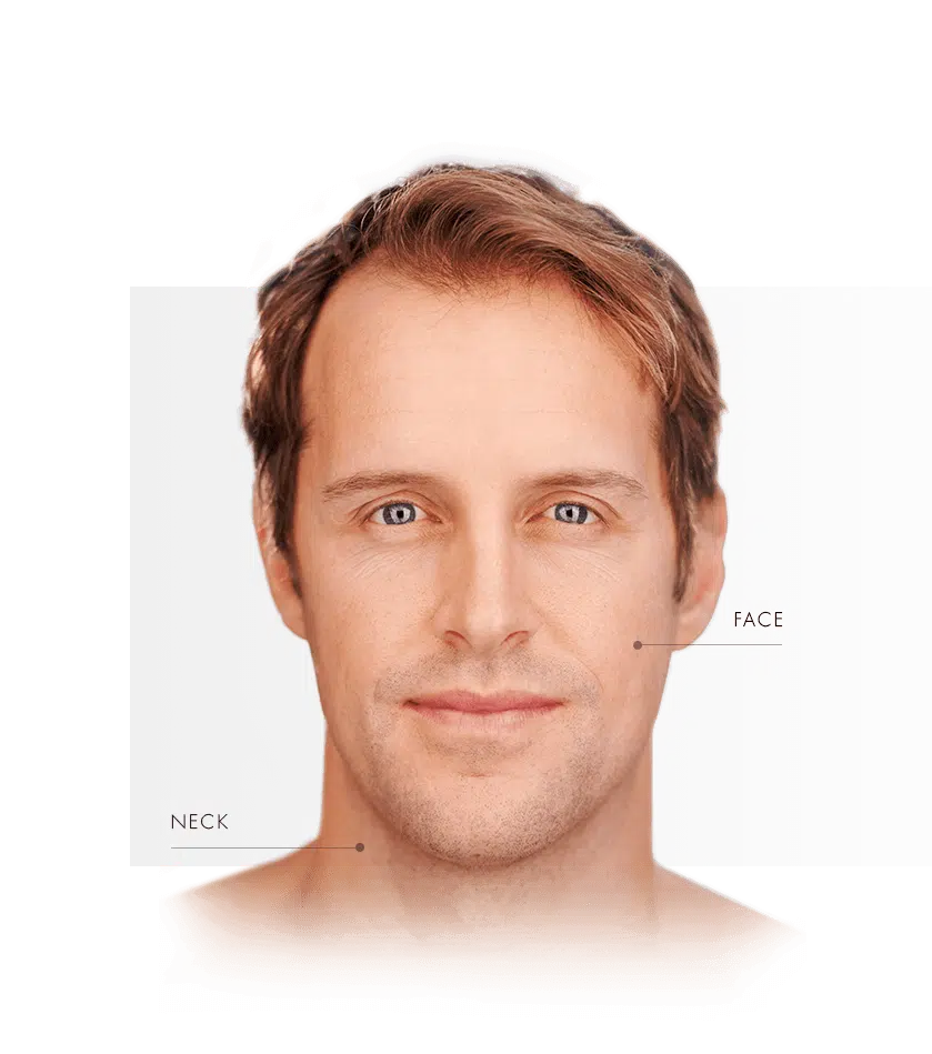 Photorejuvenation men face