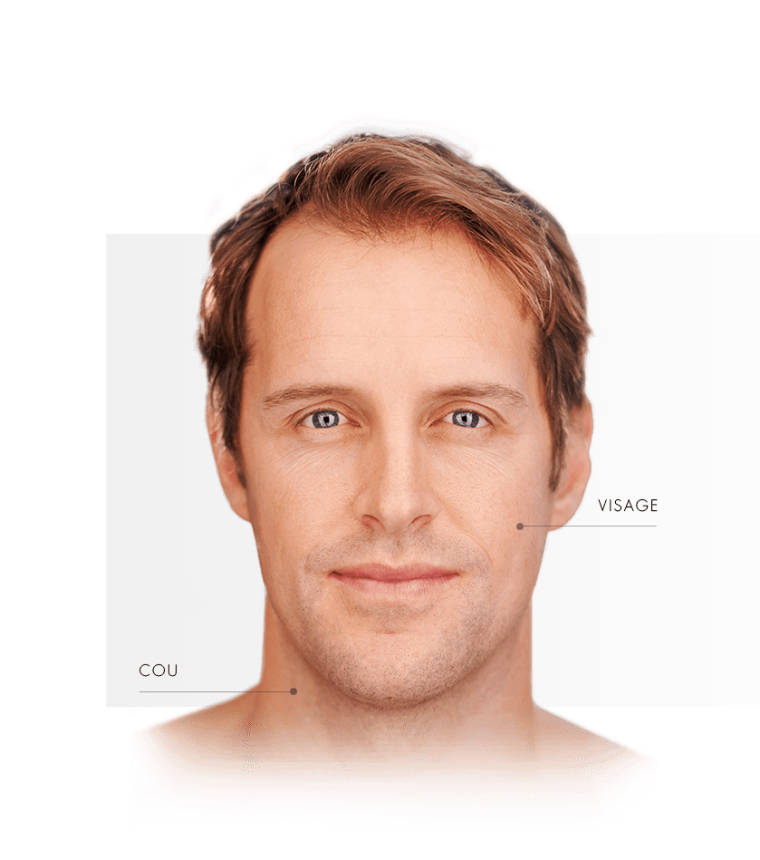 photorajeunissement-homme-zone-visage-fr-e1527618198579