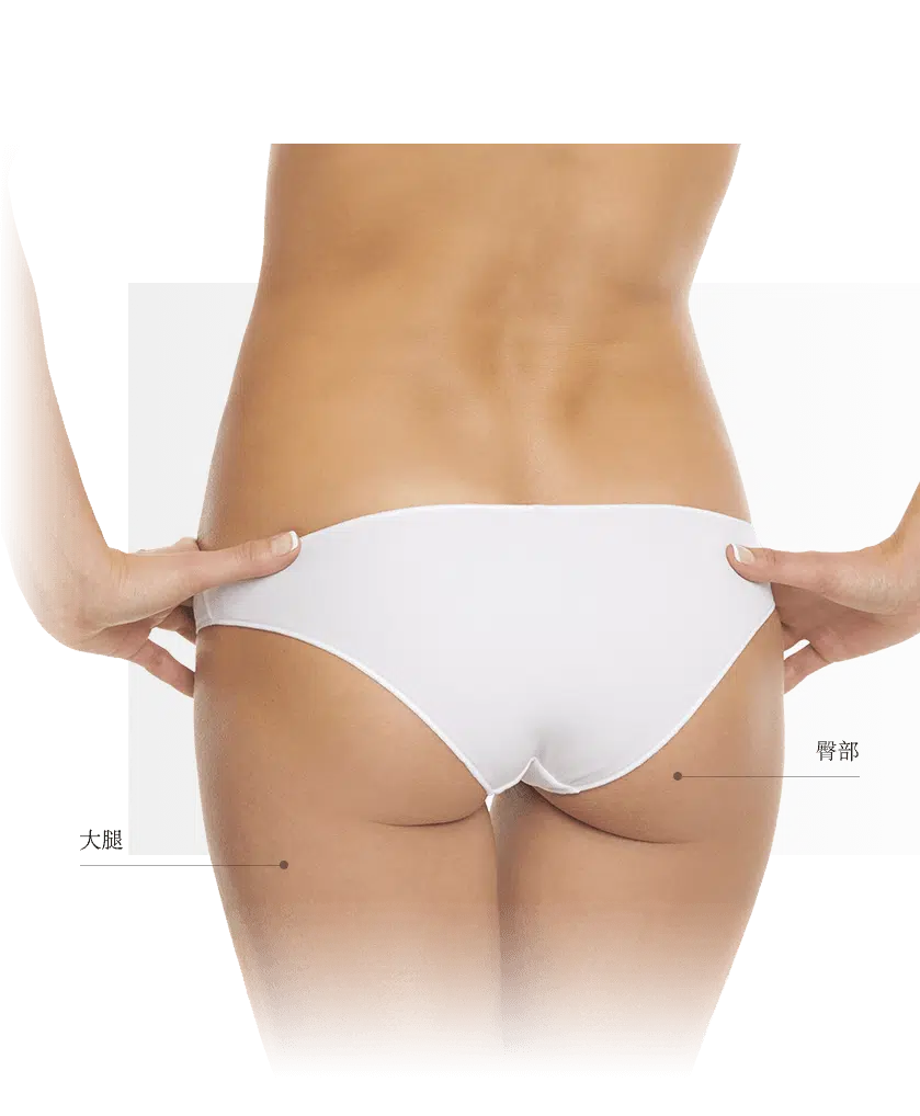 Thermage zones fesses femme