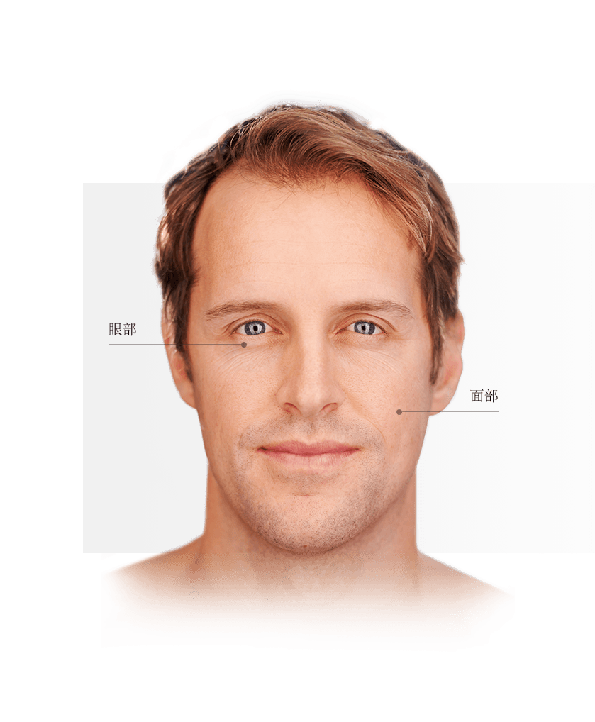 Thermage zones du visage homme