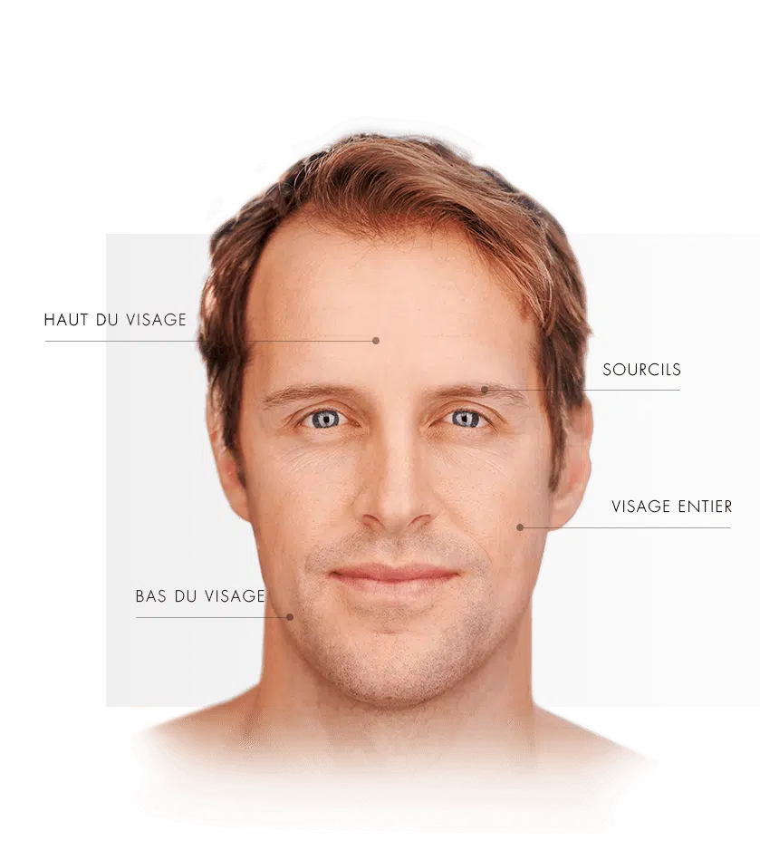 ulthera homme zone visage