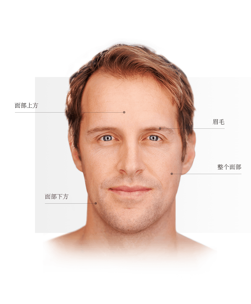 Ulthera zones du visage homme