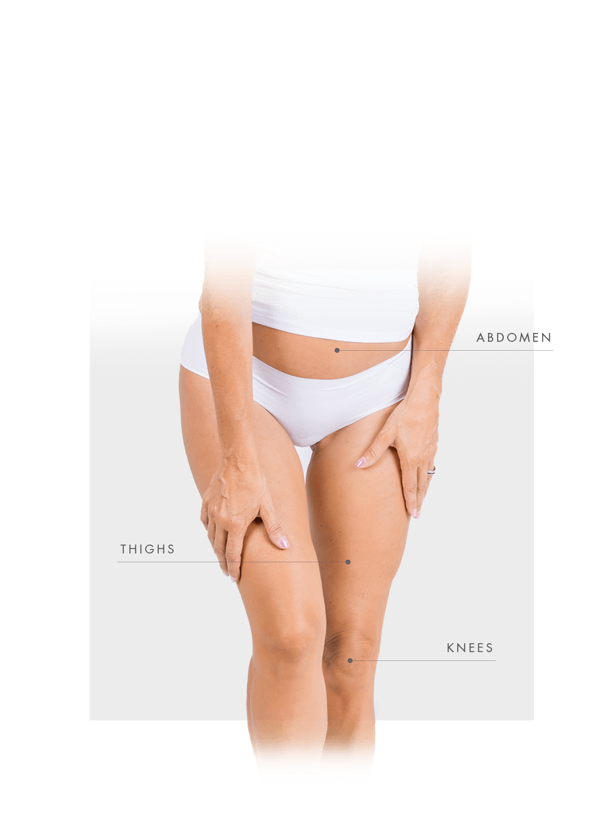 Microneedling for woman for abdomen, thighs and knees