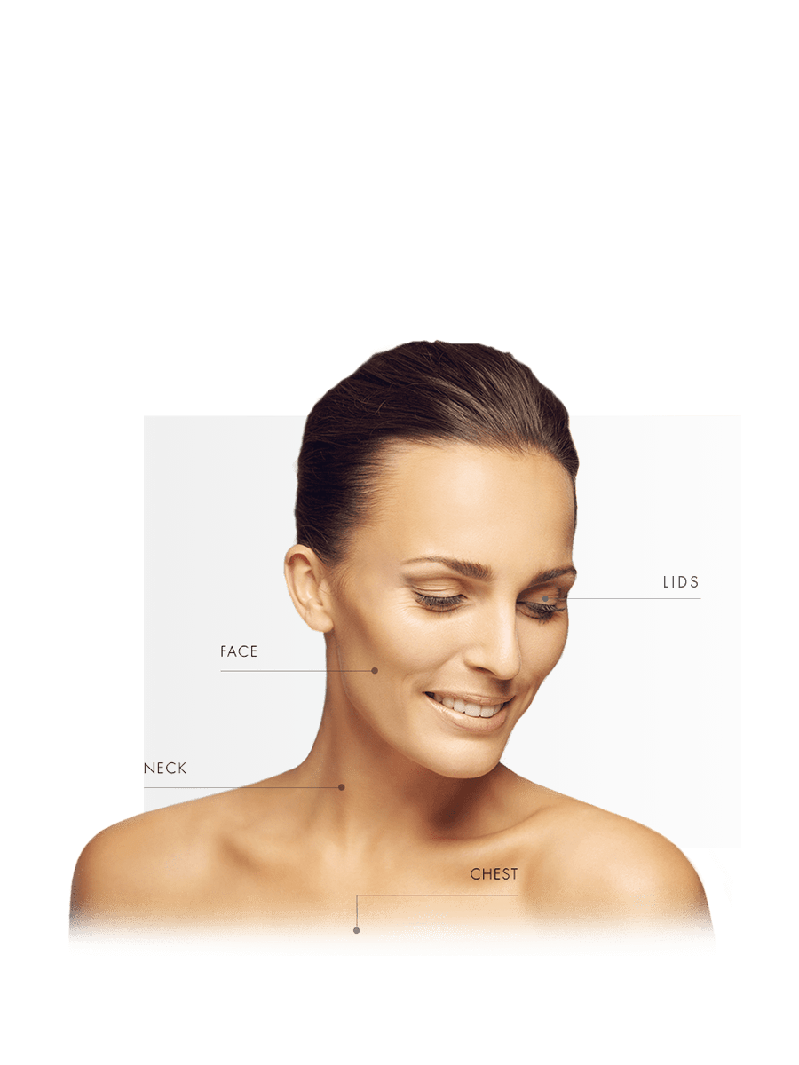 Microneedling for woman for face, lids, neck and chest