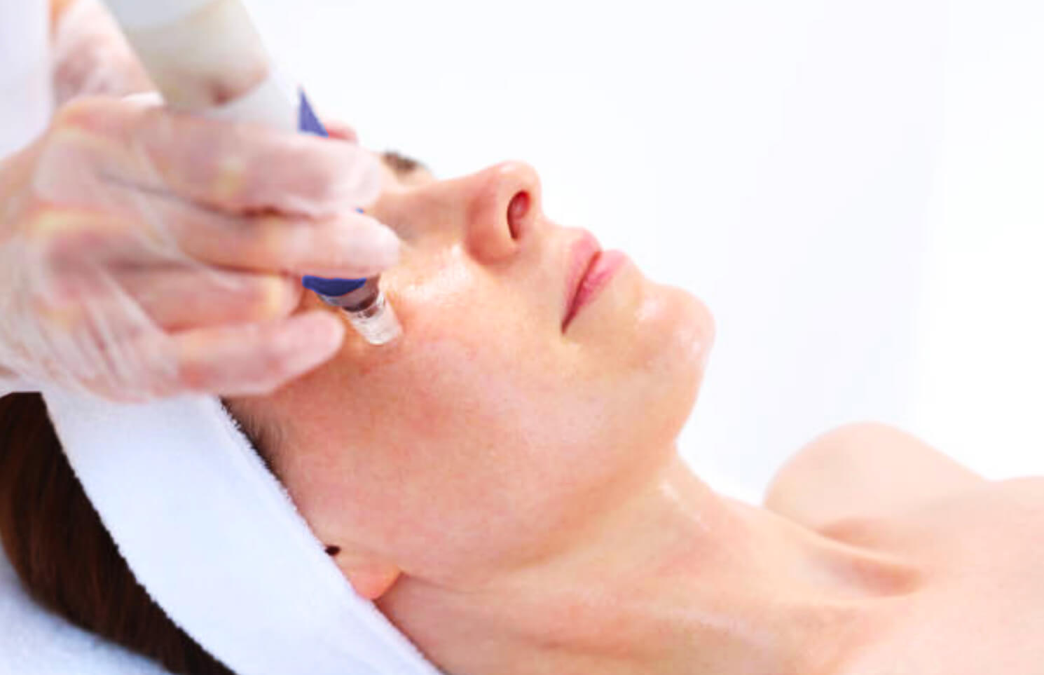 microneedle