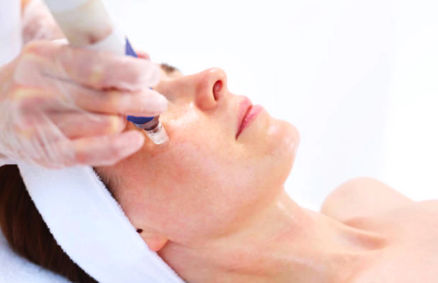 microneedle