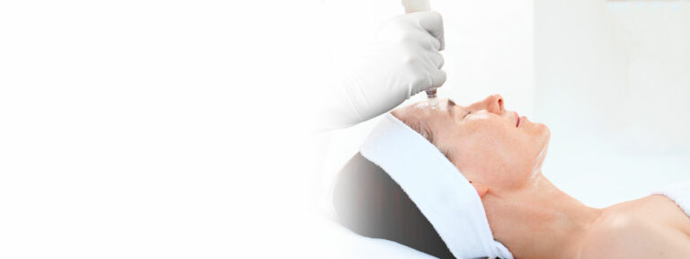 Microneedling