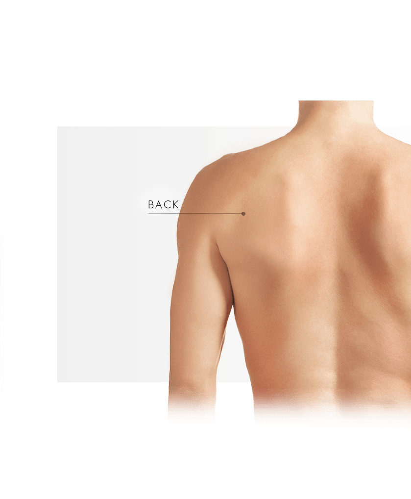 Bela treatment on the back