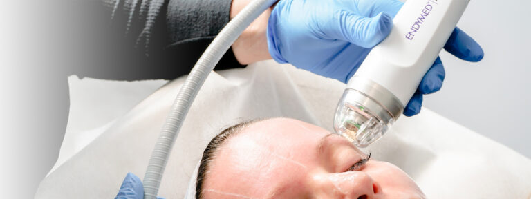 Microneedling