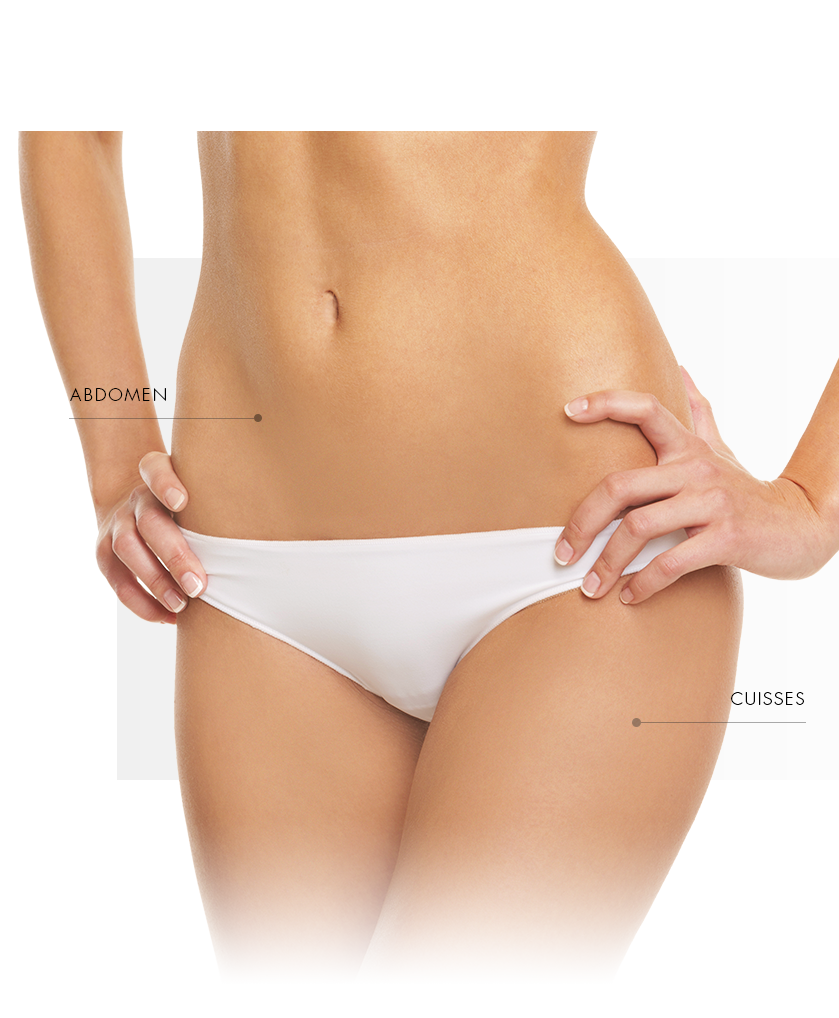 Microneedling pour l'abdomen et les cuisses