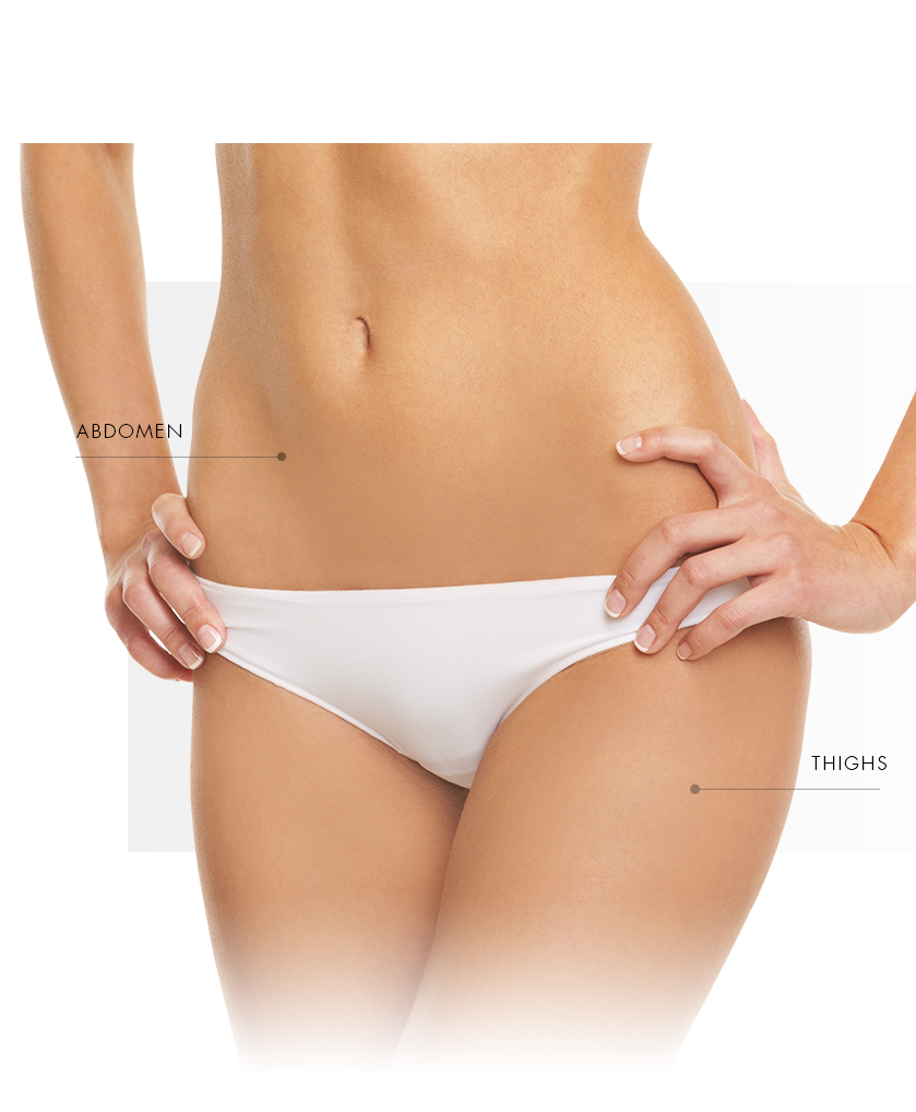 Microneedling, Endymed zone thigh