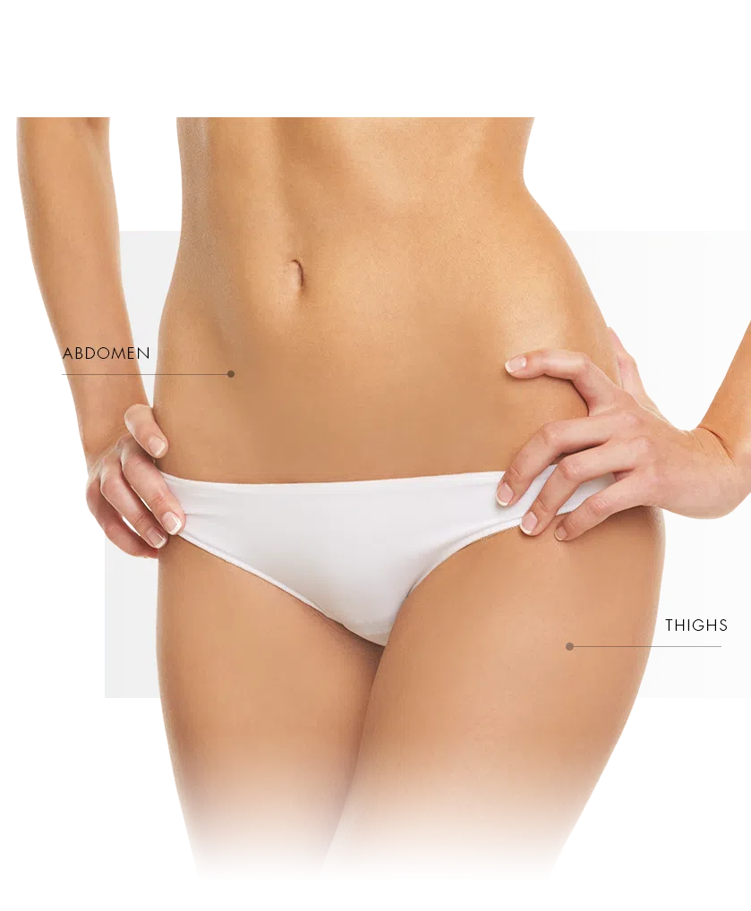 Microneedling, Endymed zone thigh