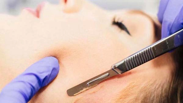 A dermapure physician treating a patient