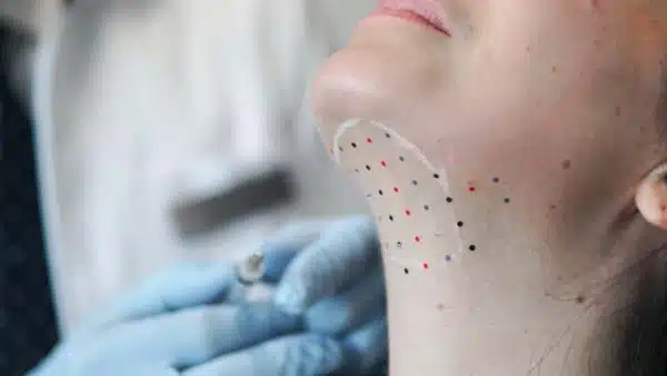 Belkyra price in Kelowna