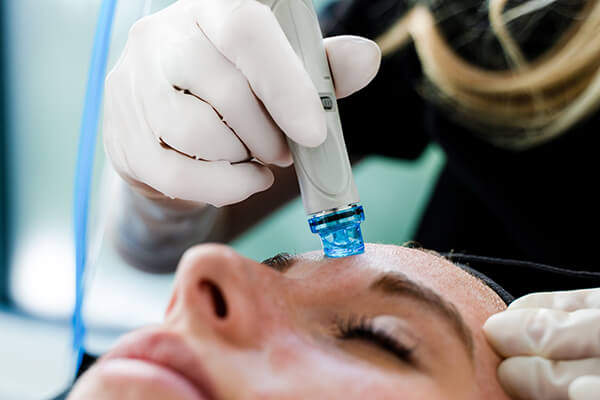 HydraFacial treatment in Vancouver