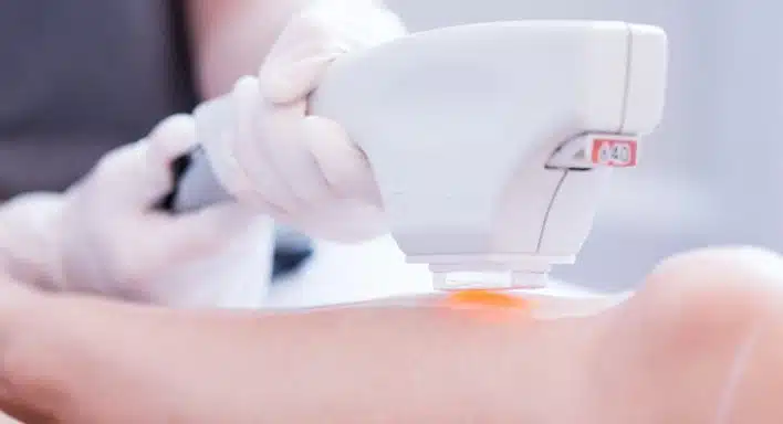 Permanent laser hair removal price in Vancouver