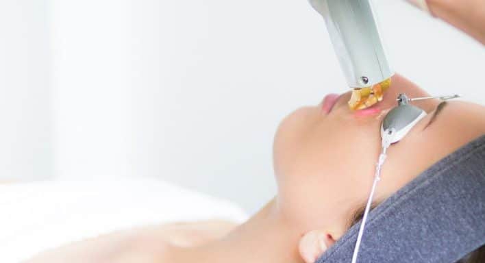 Vascular lasers in Vancouver